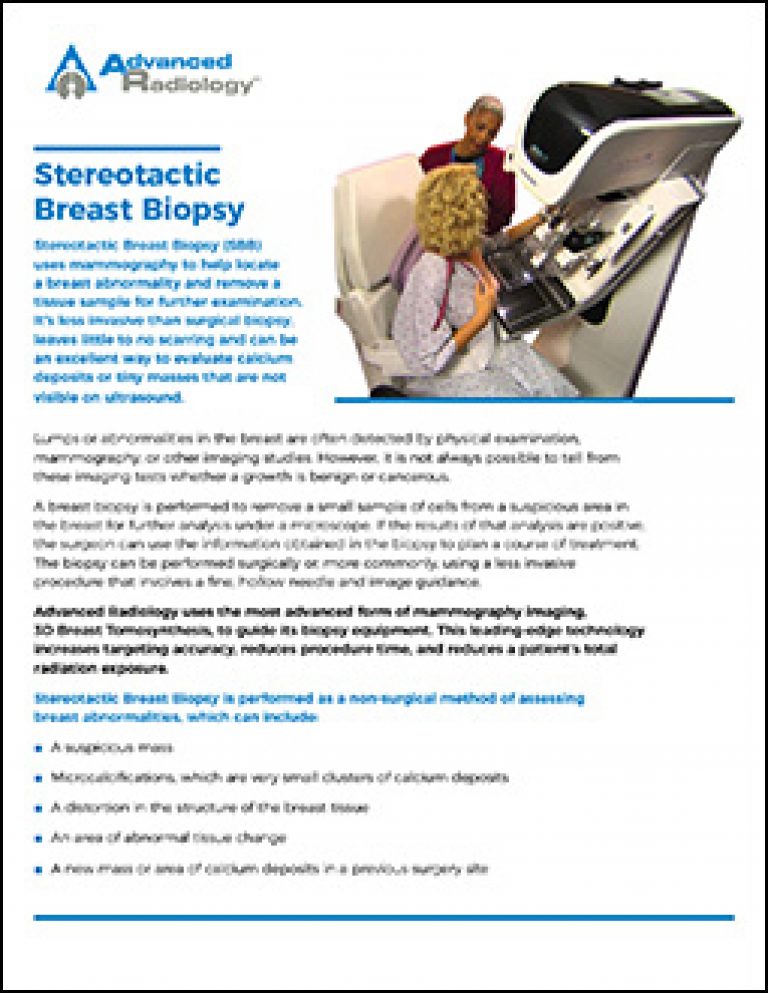Advanced radiology consultants stereotactic breast biopsy