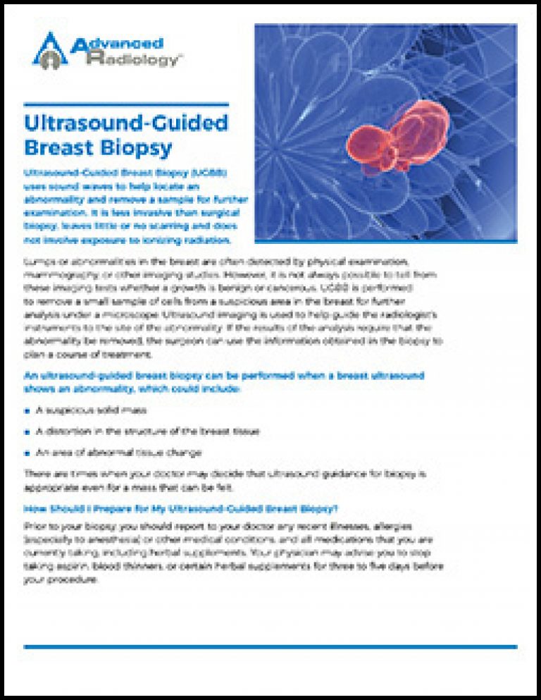 icd 10 code for ultrasound guided breast biopsy